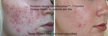 Load image into Gallery viewer, Advanced Nutrition Programme Skin Clear Biome™ 10 Day Discovery Pack
