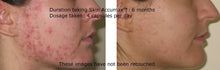 Load image into Gallery viewer, Advanced Nutrition Programme Skin Clear Biome™ 60 Capsules
